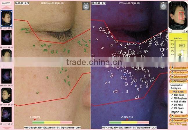 hot sell magic mirror facial skin analyzer / 3d face camera