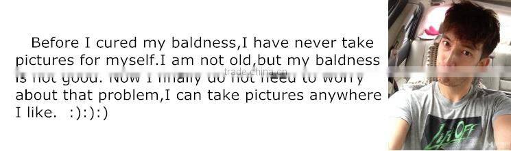 Baldness cure ionic type hair care products scalp massage comb