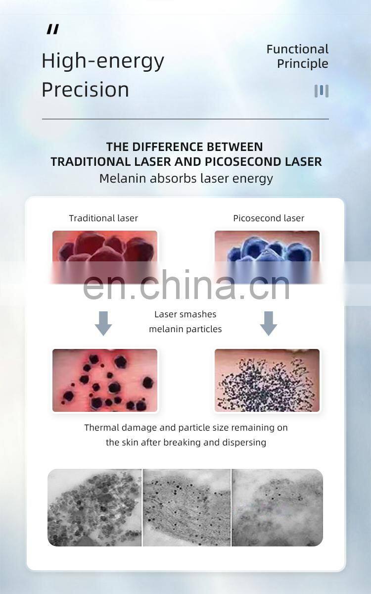 ND YAG Picosecond Carbon Peeling Laser Pigment Remover Eyebrow Tattoo Removal Machine Factory Price