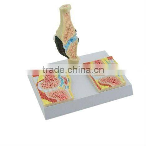 V-AM056 Anatomical Knee Sagittal Model For Medical Teaching