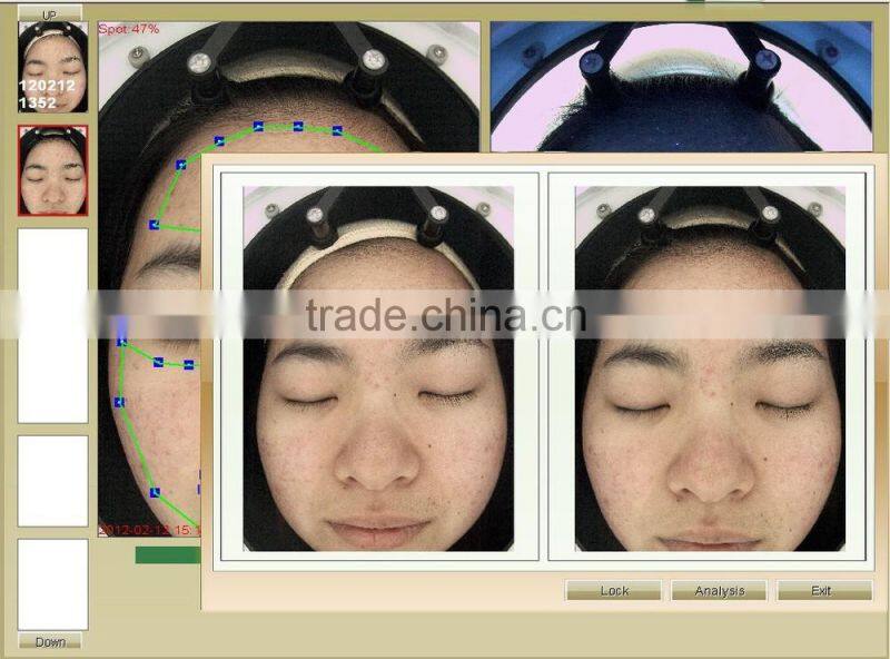 Facial skin moisture oil analyser/Skin Moisture Tester
