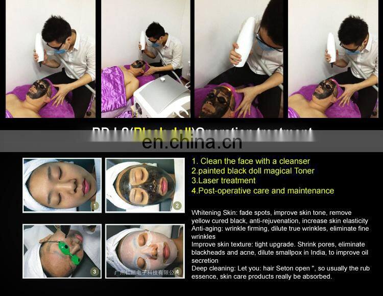 Multifunctional skin whitening eyebrow washing device Nd: Yag laser machine