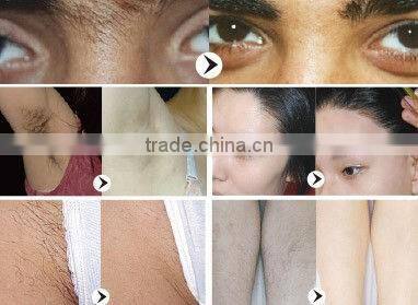 810nm diode laser professional hair removal machine / portable beauty machine for home use