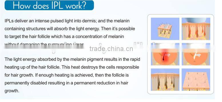 2016 YALO Hair Removal Machine for woman use