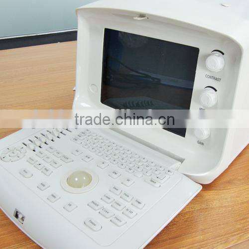 RUS-6000A Best Sale Hospital Clinic Portable Ultrasound Machine/Scanner with convex, transvaginal, linear, rectal probe-Shelly