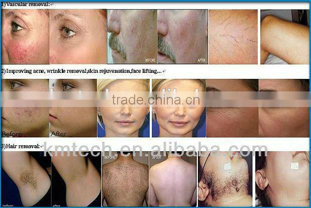 Professional 5 in 1 multifunctional beauty equipment