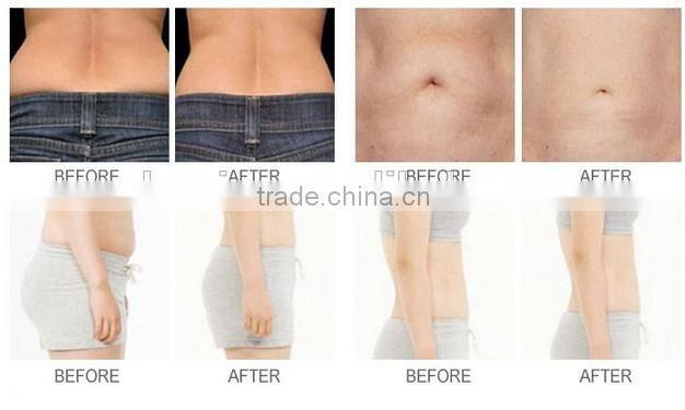 R9-Riva 4in1 RF Cavitation body shape smachine