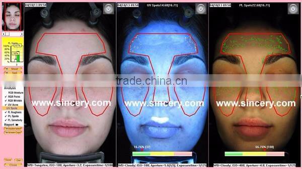 Iris skin scanner skin diagnostic equipment