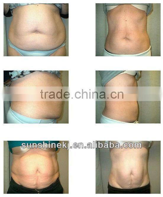 2016 Hot 5 treatment handles cavitation radio frequency ultrasonic facial beauty equipment for salon use