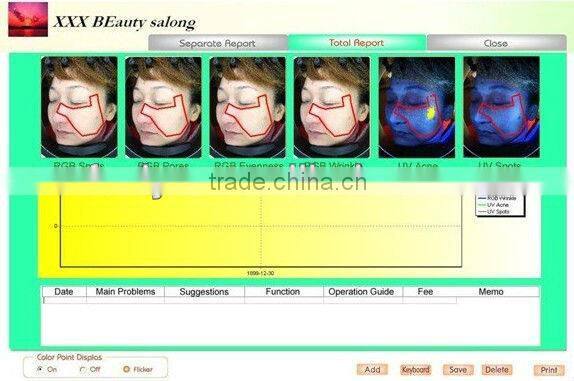 High Quality and High Accuracy Light Detector Magic Mirror Facial Skin Analyser Analyzer