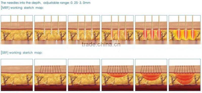 fractional rf / rf fractional micro needle / rf face lifting machine