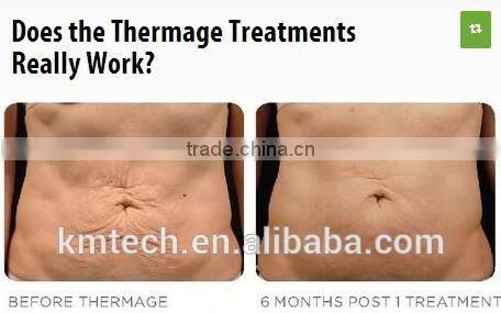 CE ISO TUV BV approved machine radio frequency facial for skin tightening