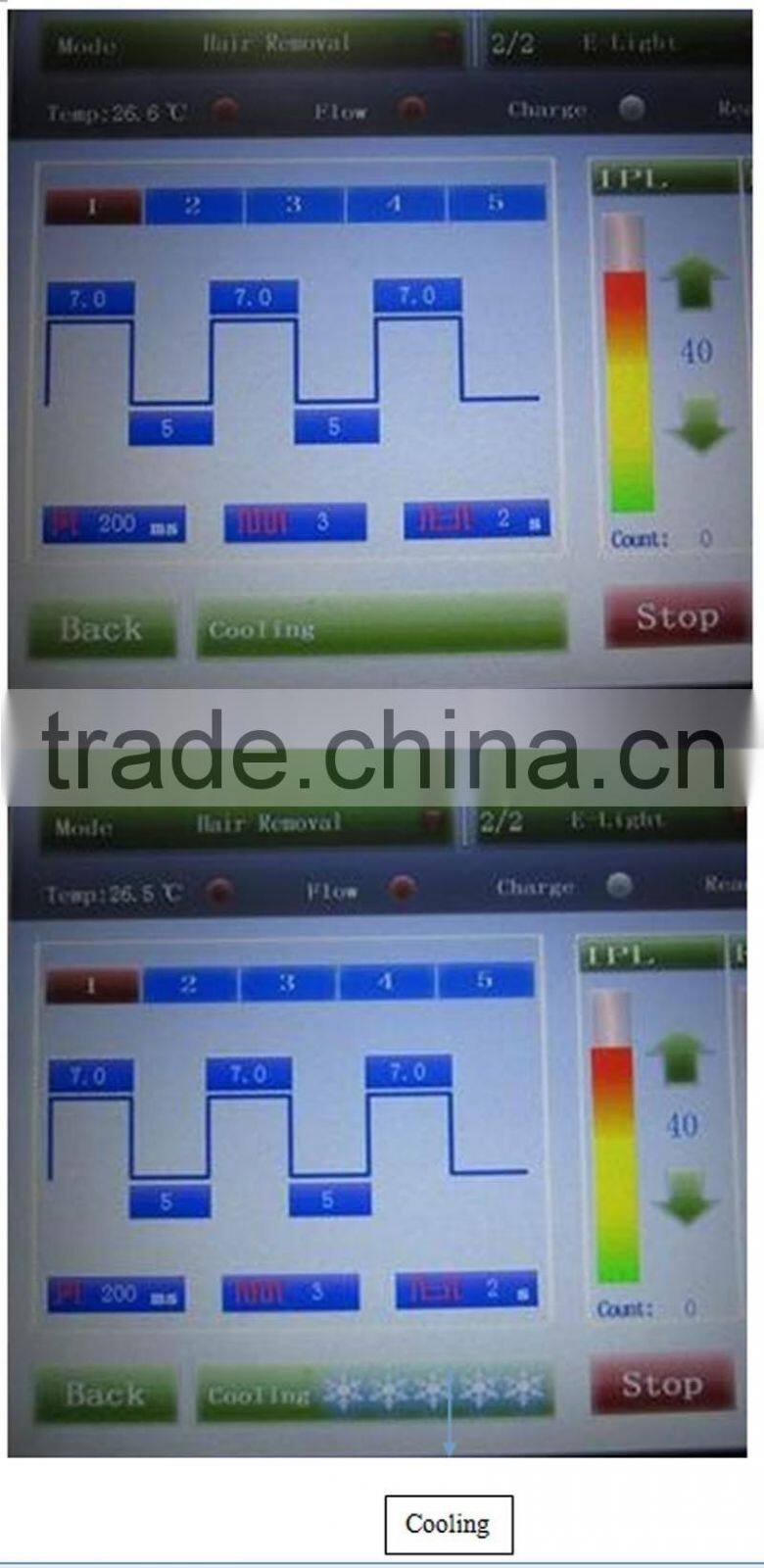 IPL 3in1 tattoo removal laser/new laser for tattoo removal/laser tattoo removal machine factory price