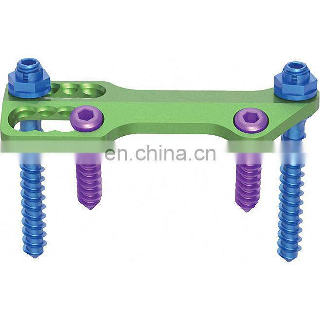 High Quality Spine Product Implant Anterior Thoracolumbar Plate System