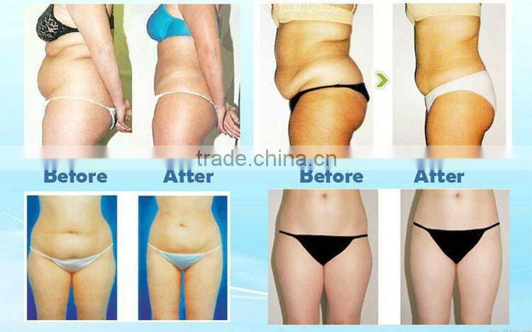 Japan imported pads! 650nm Lipo slim machine fat reducing laser