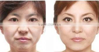 radio frequency skin tightening device home use