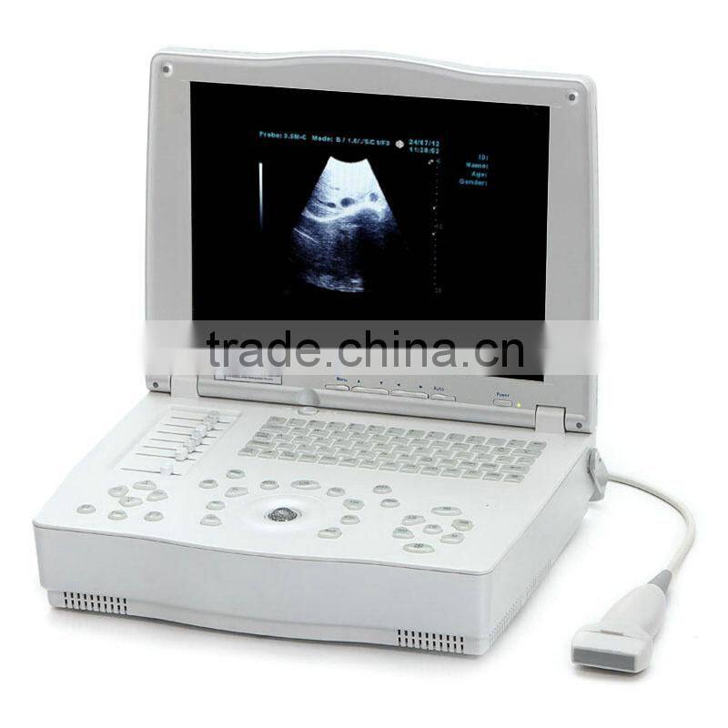 15-inch Laptop Ultrasound Scanner with Multi-frequency probes