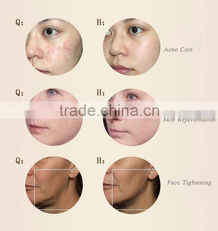 Hot Sale Vibrating Massage g5 slimming machine for sale Skin Whitening