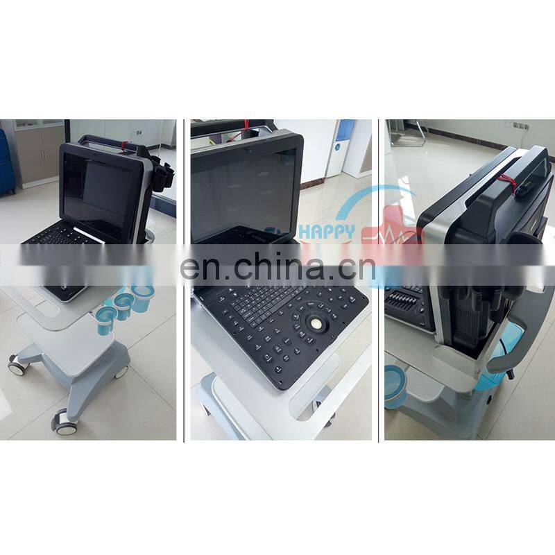 HC-A012F Ultrasound Scanner The Most Economical Portable Color Doppler Ultrasound Scanner color doppler ultrasound machine