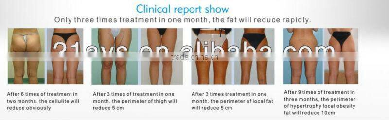Ultrasonic liposuction rf & fat cavitation slimming weight loss machine