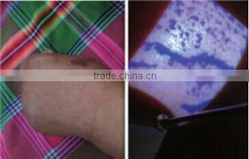 Adults Children Suitable Vein Viewer Display Vein Viewer