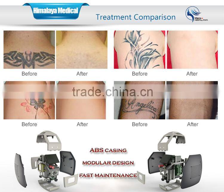 Q switch nd yag tattoo removal machine Pigment Removal equipment for sale