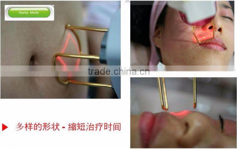 Hot selling professional 1550 diode laser acne scar removal anti aging