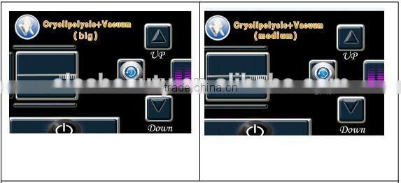 China Vertical Slimming Machine,Cryo Slimming Machine,Body Shaper Slimming Machine