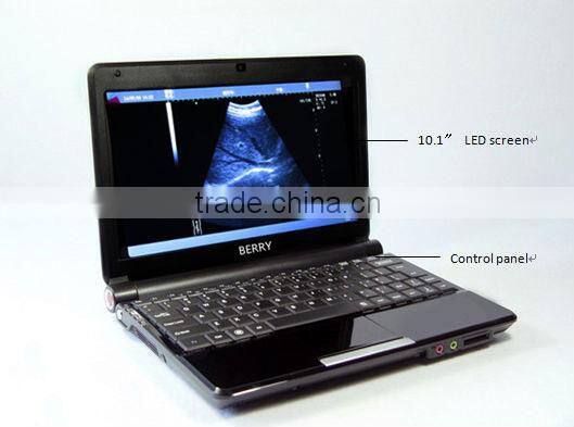 low price Portable Ultrasound machine, mini laptop Ultrasound Scanner
