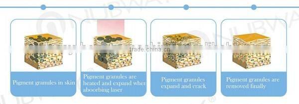 Powerful 1064nm Nd Yag Q Switched Laser Tattoo Removal Machine