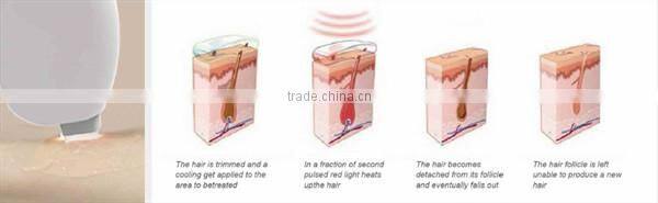 Permanent Laser Hair Removal Machine Diode Laser Cost of Laser Home Salon Use