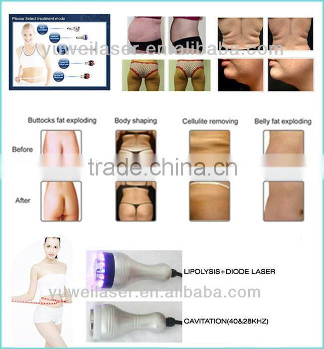 2017 new technology multifunctional rf +cavitation + vacuum fitness slimming equipment