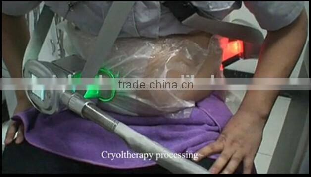 freeze fat machine / freeze fat / cryotherapy fat freezing device