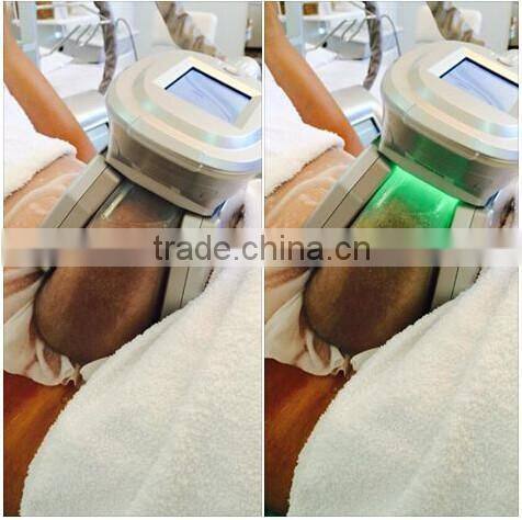 Technology 2016 fat loss cryolipolysis cold body sculpting cryo fat freeze slimming machine