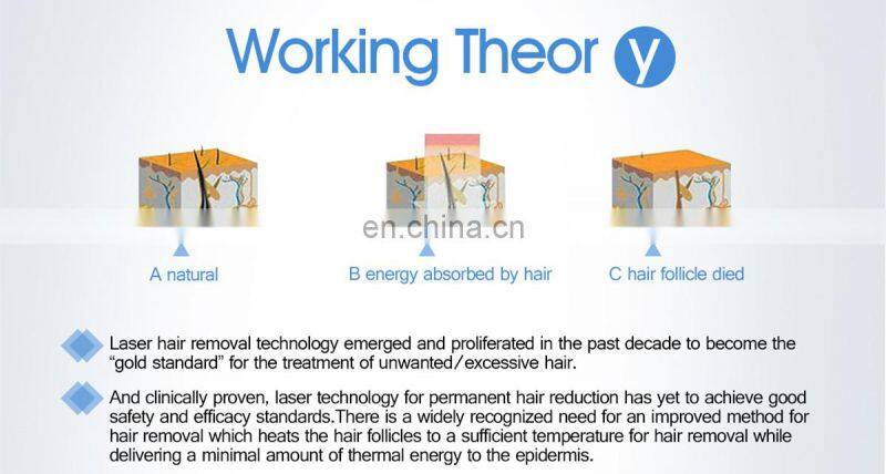 2020 salon equipment 755nm 808nm 1064nm diode portable laser hair removal