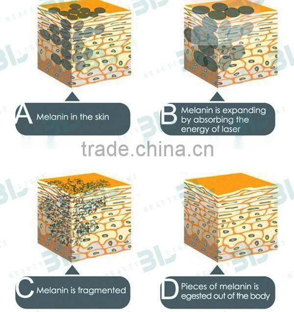 Laser nd yag 1064 hair removal skin whitening device with three heads