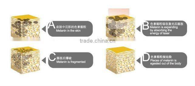 Best price Laser Makeup Eyebrow Removal Machine Manufacturer