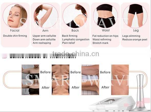 shockwaves machine for Cellulite removal/Loose skin get tightened/Connective tissue /Body Reshaping and slimming