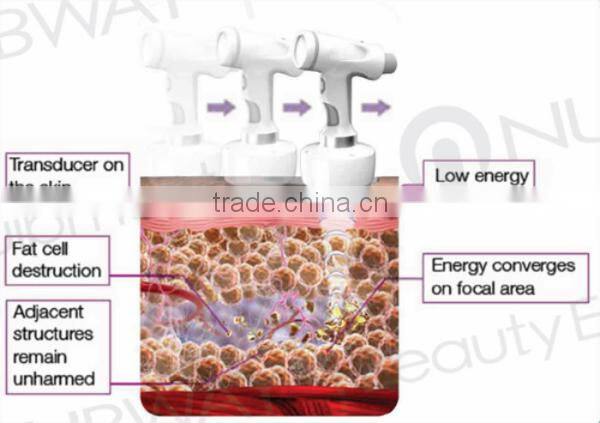 Non-invasive Fat Cell Destruction Fast Weight Loss HIFU Body Slimming Machine