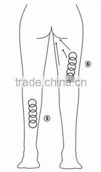 HOT seller cheapest price Easy to operating multipolar bipolar RF machine