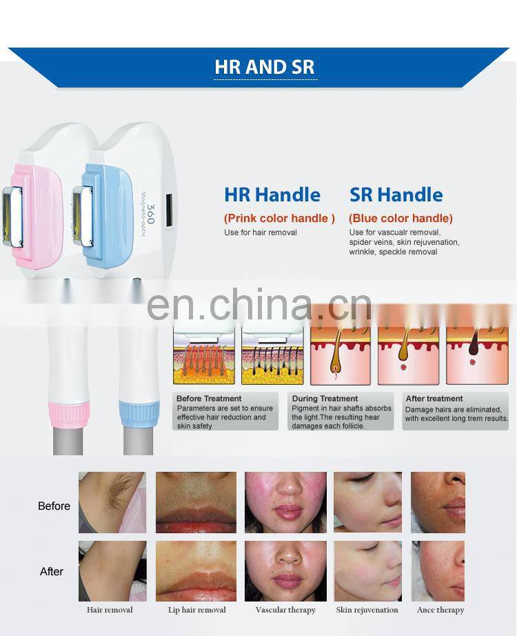 2019 New 360 magneto-optical 4in 1 IPL+OPT+ND YAG  laser+RF rejuvenation tattoo hair removal multifunctional machine