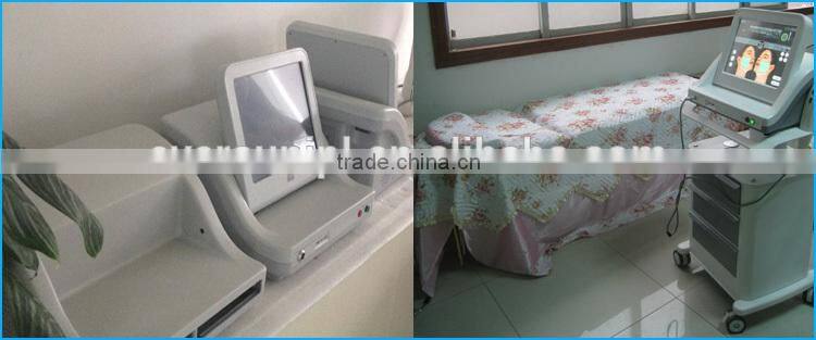HIFU equipment for old woman wrinkle removal (HIFU-EX)
