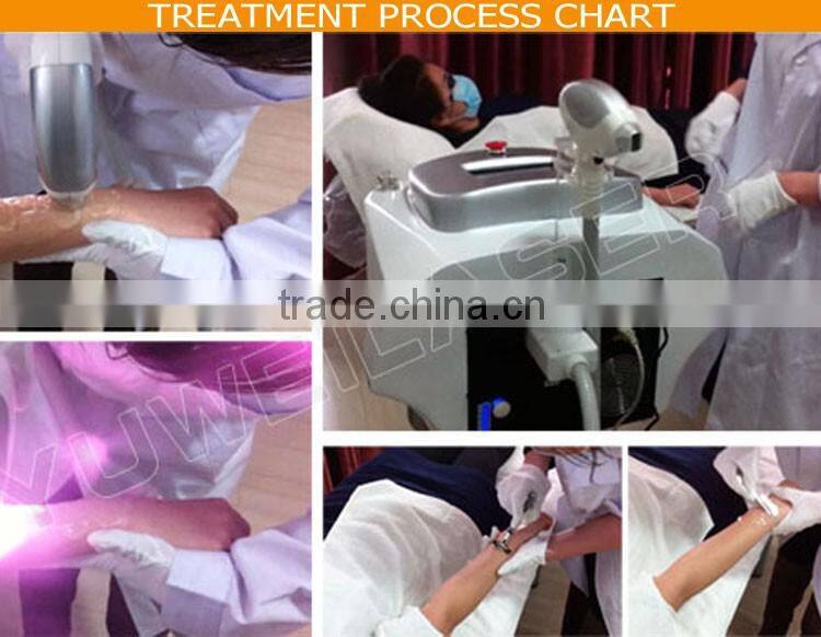New Innovative Technology new Diode Laser 808nm Hair Removal machine