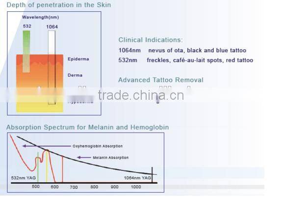 Best q-switched nd yag laser tattoo pigment removal equipment /q-switched laser skin rejuvenation machine