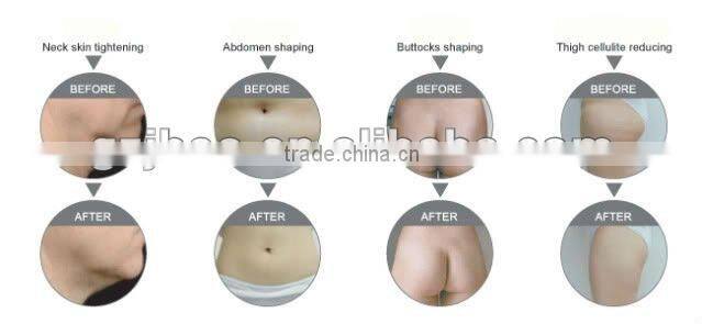 amzing effect fat belly burning machine
