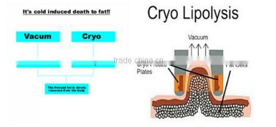 2 Handles work together!!!!! fat freezing slimming portable beauty cryolipolysis machines