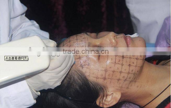 Fractional rf and microneedle for skin rejuvenation wrinkle removal