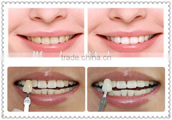 High quality teeth whitening machine supplies