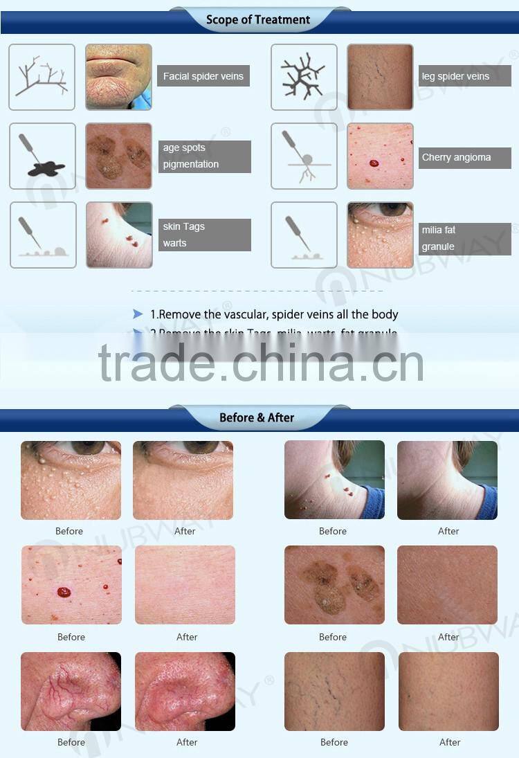 Portable 0.01mm/0.03mm(Diameter) 150W multifunction facial beauty machine