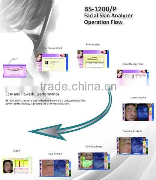 Portable medical skin testing wood lamp skin scope analyzer magic mirror